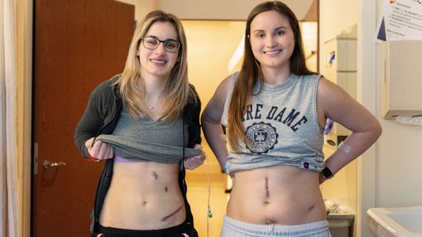 Georgia Sisters Donate Kidneys, Giving Dad and Stranger a Second Chance