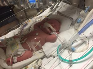 A Baby Born 24 Weeks Early Goes Home After 147 Days in The Hospital: "Defied all odds"